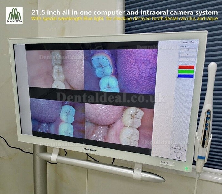 Magenta YF-2200P+ Touch Screen Intraoral Camera with 21.5 Inch LCD Monitor VGA+HDMI