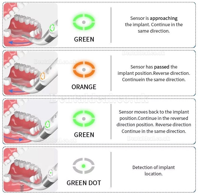 YAHOPE iD1 Dental Implant Detector Implant Abutment Locator Smart 360°Rotating Sensor